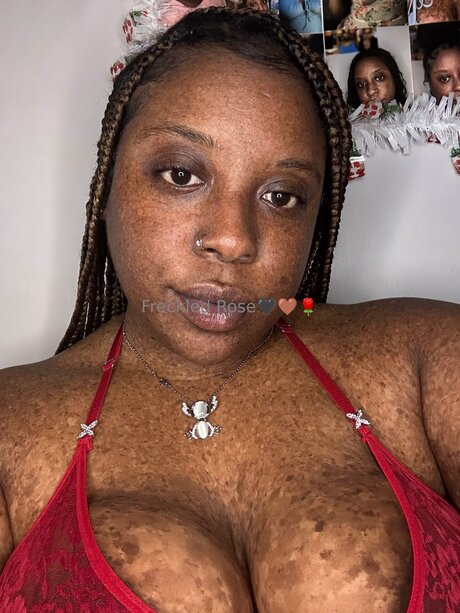 Freckledfantasy5
