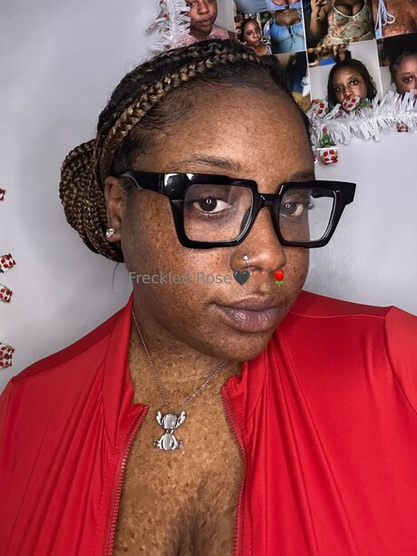 Freckledfantasy5