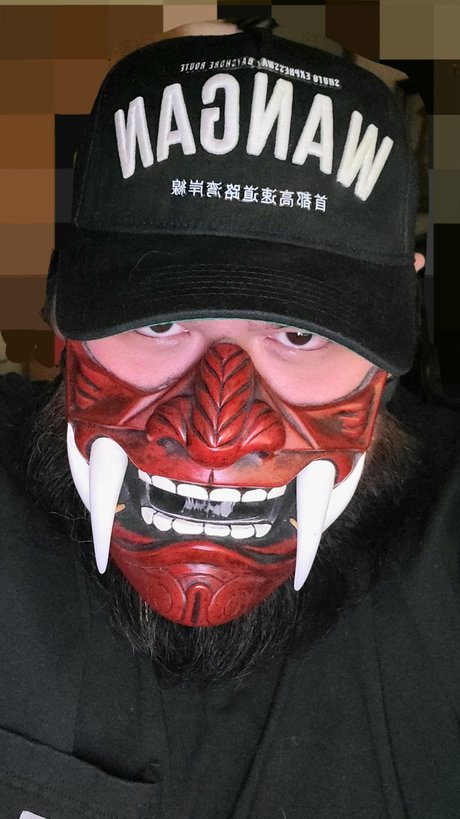 Mr 817 Asian Amputee