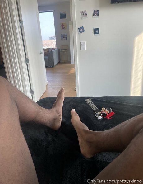 Prettyskinboi